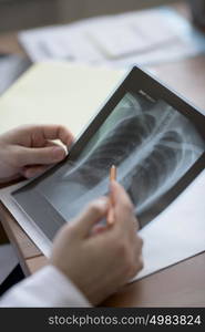 Hands of doctor holding chest and lungs xray in medical office