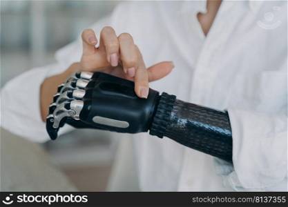 Hands of handicapped girl. Disabled young woman is setting bionic limb. Cyber prosthesis hand has processor chip, software and buttons. European girl has cybernetic carbon hand.. Hands of handicapped girl. Cyber prosthesis hand has processor chip, software and buttons.