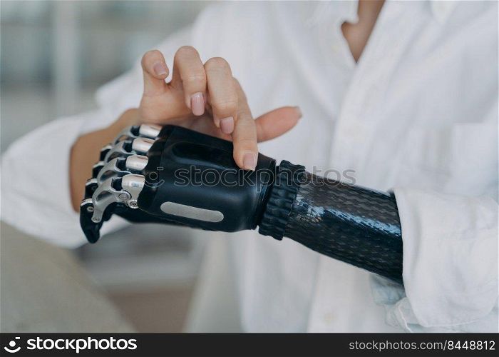 Hands of handicapped girl. Disabled young woman is setting bionic limb. Cyber prosthesis hand has processor chip, software and buttons. European girl has cybernetic carbon hand.. Hands of handicapped girl. Cyber prosthesis hand has processor chip, software and buttons.