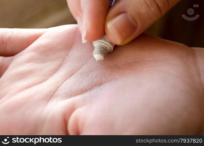 Hands with care cream closeup - dry skin