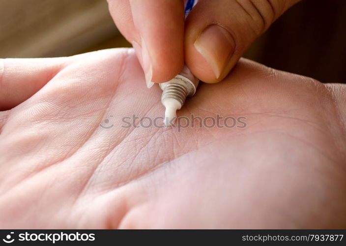 Hands with care cream closeup - dry skin