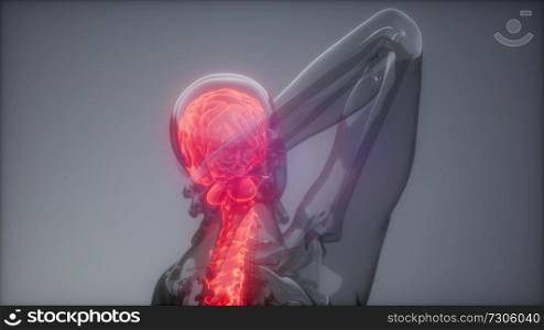 Head Pain Headache - Male Hurt Backbone