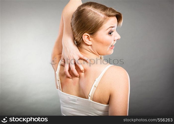 Health problem, skin diseases. Young woman scratching her itchy back with allergy rash. woman scratching her itchy back with allergy rash