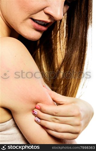 Health problem. Young woman scratching her itchy arm with allergy rash