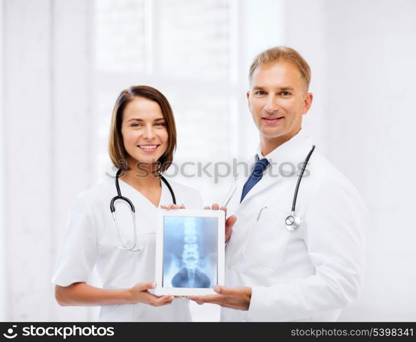 healthcare, medical and radiology concept - two doctors showing x-ray on tablet pc