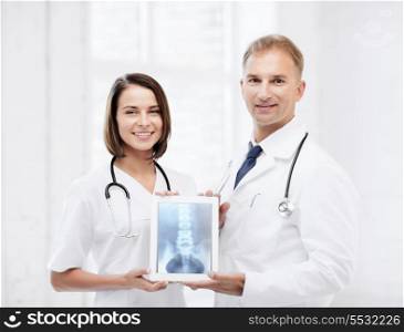 healthcare, medical and radiology concept - two doctors showing x-ray on tablet pc