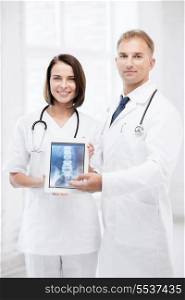 healthcare, medical and radiology - two doctors showing x-ray on tablet pc