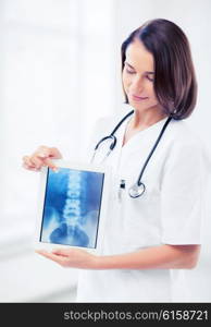 healthcare, medical and technology concept - female doctor with x-ray on tablet pc