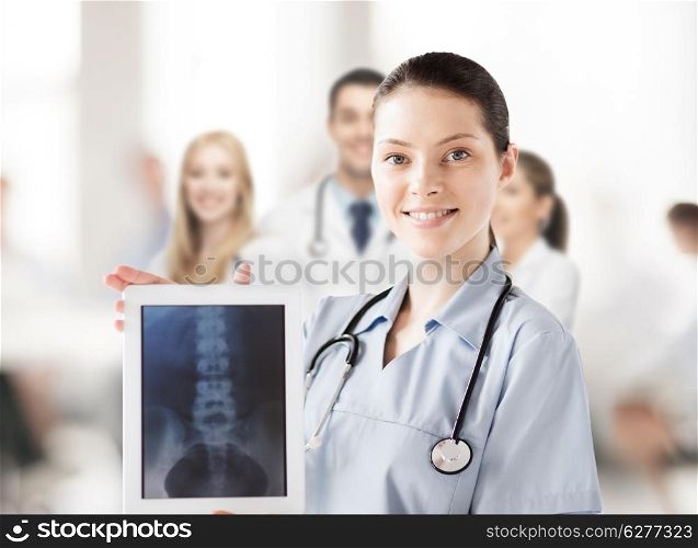 healthcare, medical and technology concept - female doctor with x-ray on tablet pc