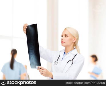 healthcare, medicine and radiology concept - serious female doctor looking at x-ray