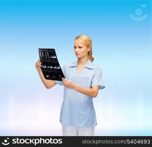 healthcare, medicine and radiology concept - smiling doctor or nurse looking at x-ray