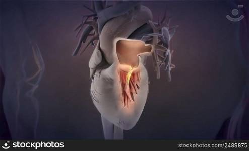 heart valve inflammation 3D illustration. heart valve inflammation 3d medical