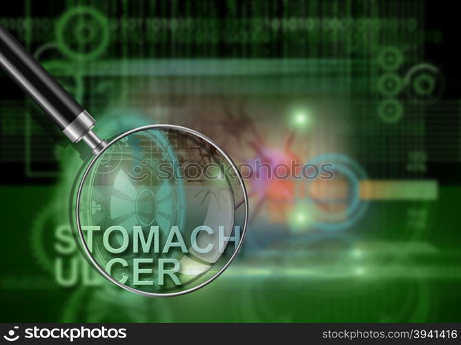 hi tech infographics of stomach ulcer made in 3d software