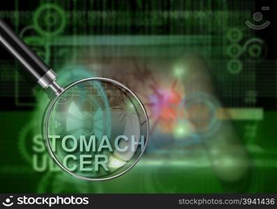 hi tech infographics of stomach ulcer made in 3d software
