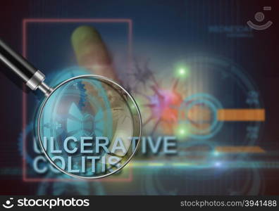 hi tech infographics of ulcerative colitis made in 3d software