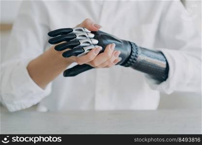 High tech carbon electronic hand. Disabled young woman is assembling bionic arm with hand. Steel cyber hand has software and buttons. Modern technology for wellbeing. Rehabilitation after trauma.. High tech carbon electronic hand. Modern technology for wellbeing. Rehabilitation after trauma.