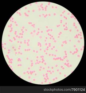 Human blood under the microscope (Blood Smear Human) 400x&#xA;