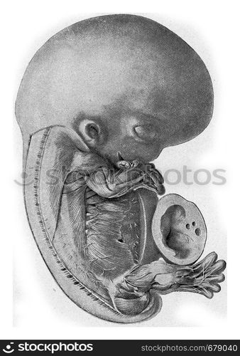 Human embryo, vintage engraved illustration. From the Universe and Humanity, 1910.