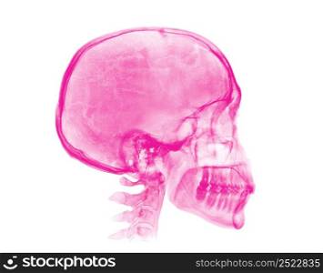 Human skull. Pink X-ray image isolated on white background. Human skull. Pink X-ray image on white background