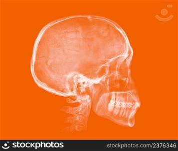Human skull. X-ray image isolated on orange background. Human skull. X-ray image on orange background