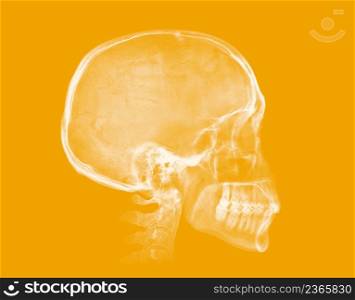 Human skull. X-ray image isolated on yellow background. Human skull. X-ray image on yellow background