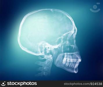 Human skull X-ray image on a blue background. Human skull X-ray image