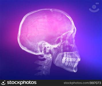 Human skull X-ray image on a colorful background. Human skull X-ray image