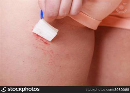 Human sticking plaster adhesive bandage to wound.. Closeup of human hand sticking plaster adhesive bandage to wound cut skin. Medical.