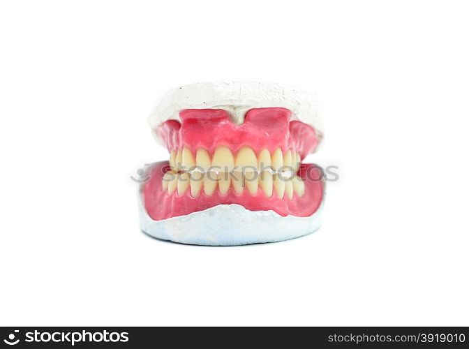 human wax dental teeth mold isolated on white