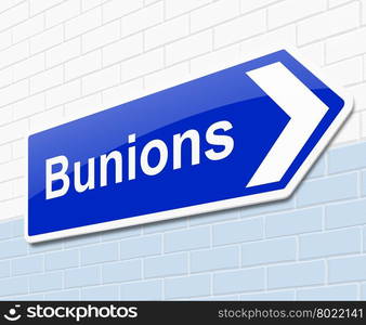 Illustration depicting a sign with a bunions concept.