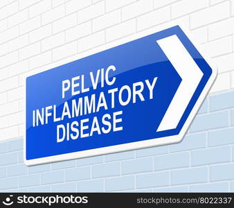 Illustration depicting a sign with a pelvic inflammatory disease concept.