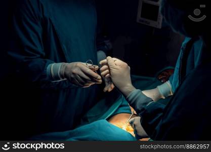 Image of surgical team perform surgery operation, nurse hand out sterile scissors to surgeon as supportive and cooperative in operation room concept.
