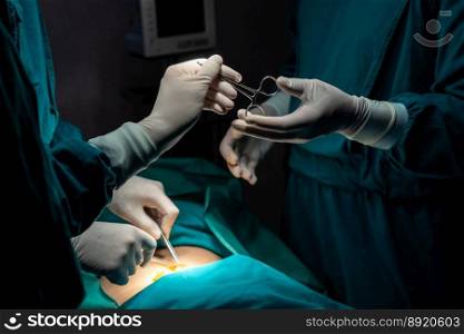 Image of surgical team perform surgery operation, nurse hand out sterile scissors to surgeon as supportive and cooperative in operation room concept.