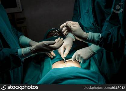 Image of surgical team perform surgery operation, nurse hand out sterile scissors to surgeon as supportive and cooperative in operation room concept.. Image of surgical team perform surgery operation nurse hand out sterile scissor.