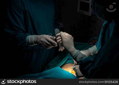 Image of surgical team perform surgery operation, nurse hand out sterile scissors to surgeon as supportive and cooperative in operation room concept.. Image of surgical team perform surgery operation nurse hand out sterile scissor.