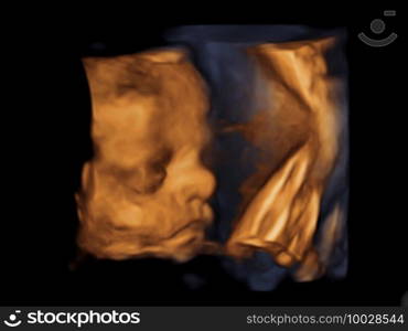 image Ultrasound 3D, 4D of baby in mother’s womb. 