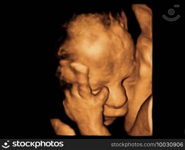 image Ultrasound 3D, 4D of baby in mother’s womb. 