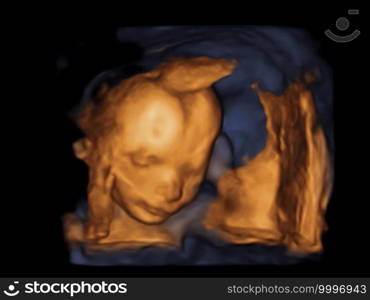image Ultrasound 3D, 4D of baby in mother’s womb. 