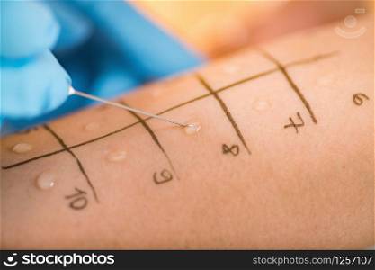 Immunologist Doing Skin Prick Allergy Test on a Woman&rsquo;s Arm. Skin Prick Allergy Testing
