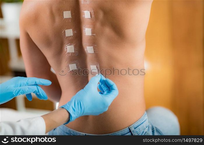 Immunologist Doing Skin Prick Allergy Test on a Woman&rsquo;s Back. Doctor Doing Skin Allergy Test