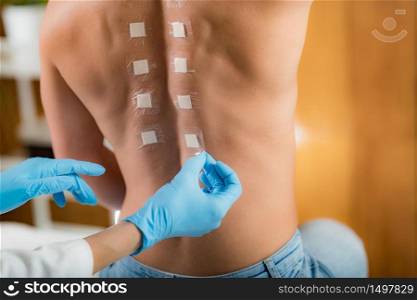Immunologist Doing Skin Prick Allergy Test on a Woman&rsquo;s Back. Doctor Doing Skin Allergy Test