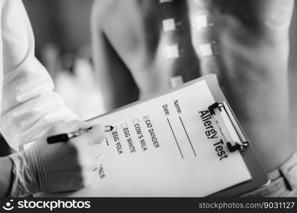 Immunologist Doing Skin Prick Allergy Test on a Woman&rsquo;s Back.  Doctor Doing Skin Allergy Test