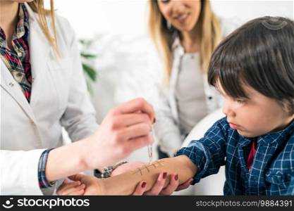 Immunologist Testing Allergy Reaction on a Boy’s Arm. Immunologist Testing Allergy Reaction of a Patient