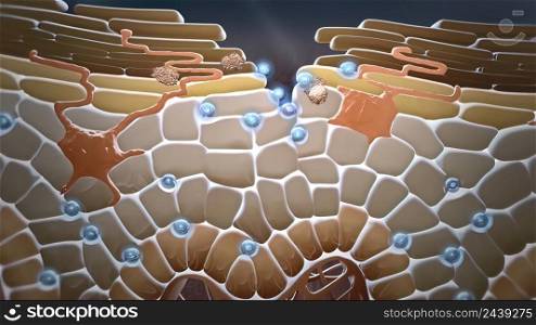 Inflammation and swelling of the skin 3D illustration,. Inflammation and swelling of the skin