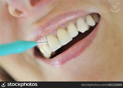 Interdental brush- Woman Cleaning Her Teeth
