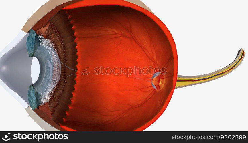 Keratoconus is an eye disease that affects the structure of the cornea. 3D rendering. Keratoconus is an eye disease that affects the structure of the cornea.