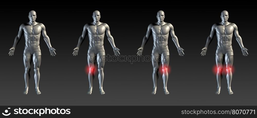 Knee Injury with Red Glow on Area Series