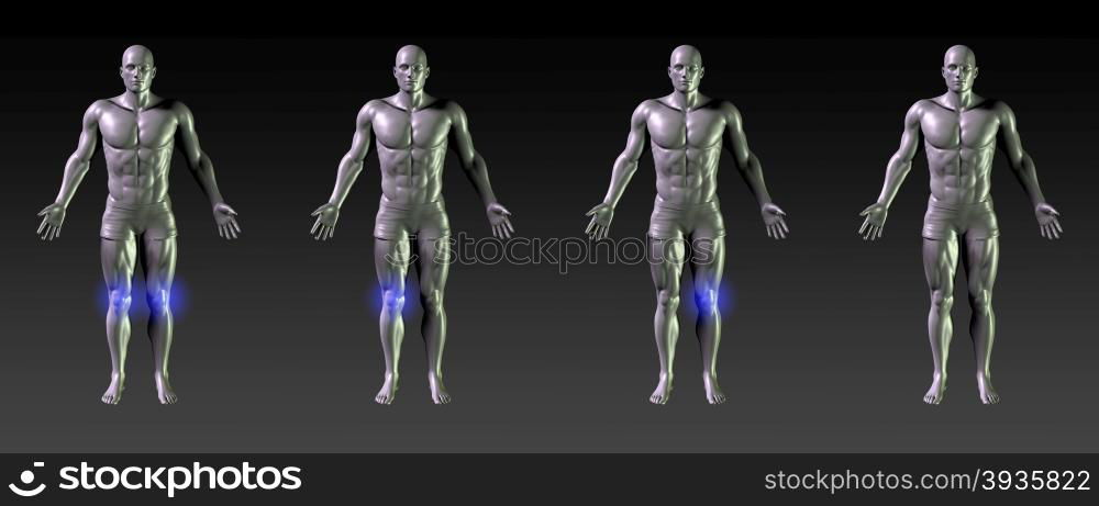 Knee Recovery or Rehabilitation with Blue Glow