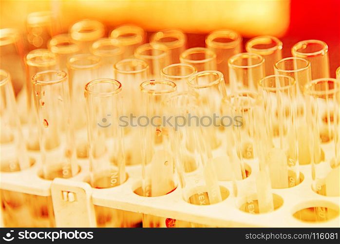 Lab science research glass items adding drop to one of several test tubes. A scientific experiment in a science research Laboratory.