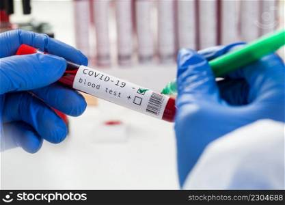 Lab scientist medical technologist labelling blood s&le test tube vacutainer,NEGATIVE result,COVID-19 virus disease, deadly contagious Coronavirus global pandemic outbreak,world health organization
